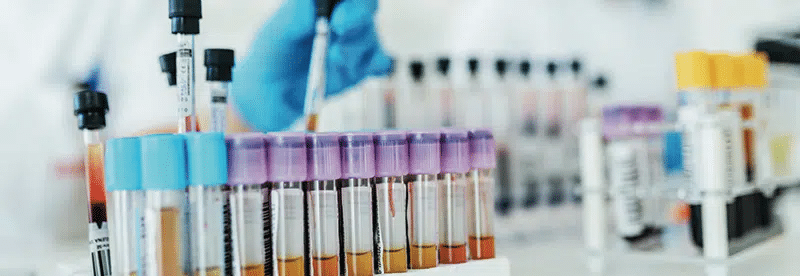 The Rise And Fall Of Theranos: Clarifying Important IP Concepts